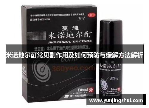 米诺地尔酊常见副作用及如何预防与缓解方法解析